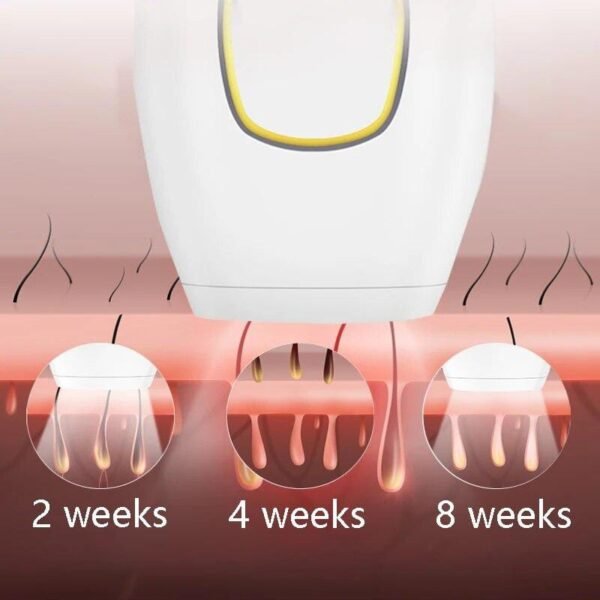 IPL HAIR REMOVAL - Image 6